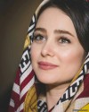الناز حبیبی با مشت به صورت خود زد! | بلایی که الناز حبیبی سر چهره خود آورد
